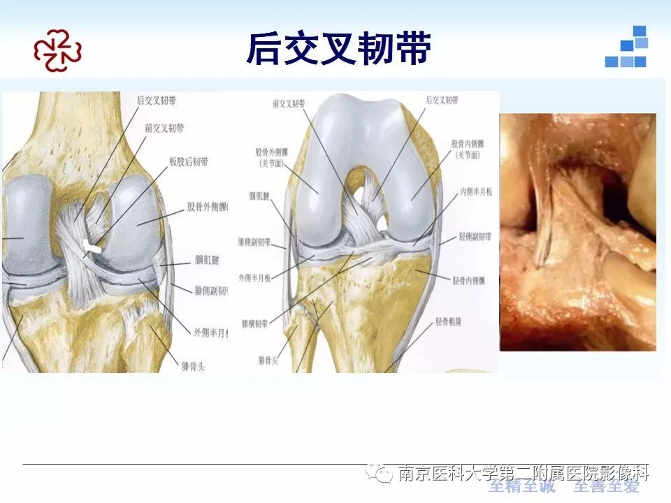 【PPT】膝关节运动损伤的MR表现