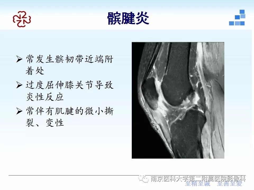 【PPT】膝关节运动损伤的MR表现