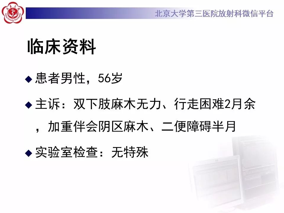 【病例】脊柱骨母细胞瘤1例CT及MR