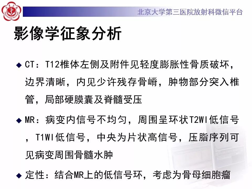 【病例】脊柱骨母细胞瘤1例CT及MR