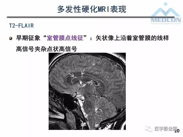 【PPT】MR在MS诊断与鉴别诊断中的价值