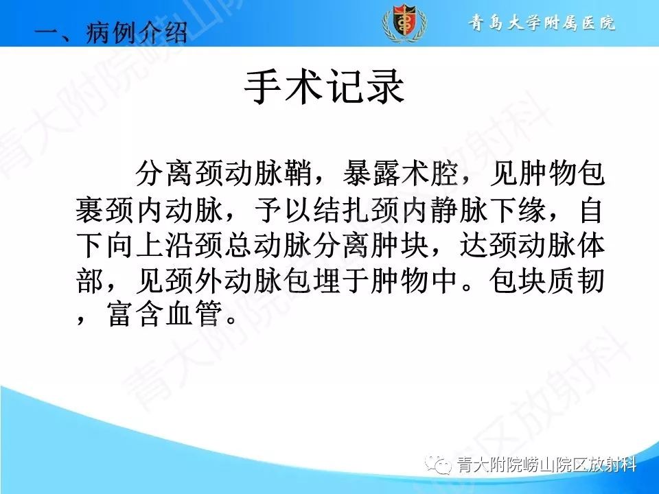 【PPT】颈动脉间隙占位性病变的影像鉴别诊断