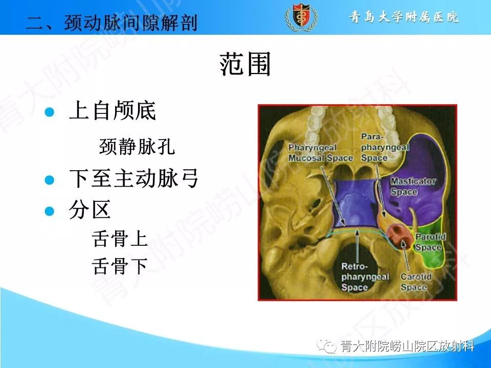 【PPT】颈动脉间隙占位性病变的影像鉴别诊断
