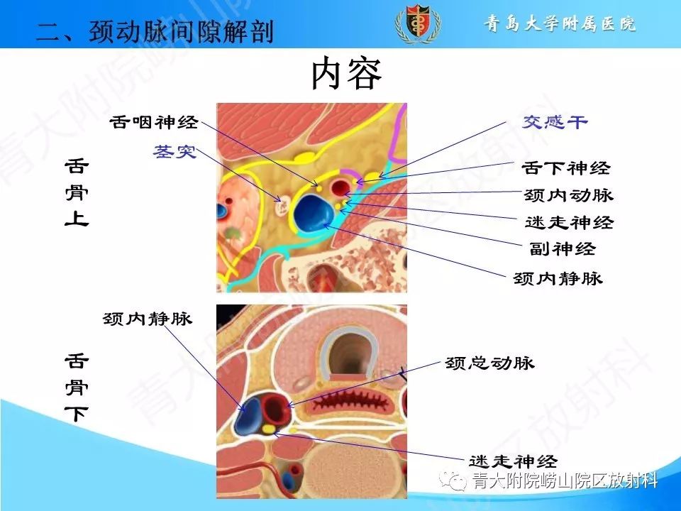 【PPT】颈动脉间隙占位性病变的影像鉴别诊断