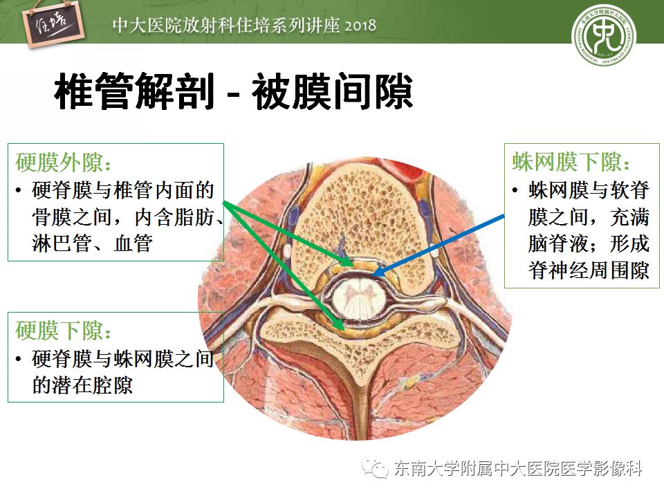 【PPT】脊髓内常见疾病的MR诊断