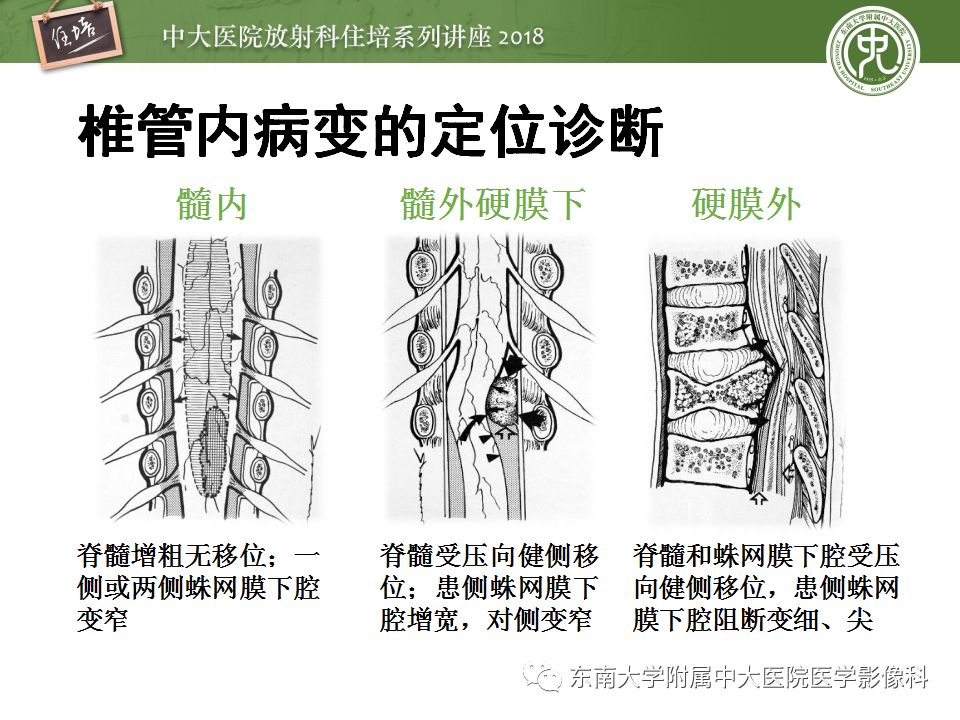【PPT】脊髓内常见疾病的MR诊断