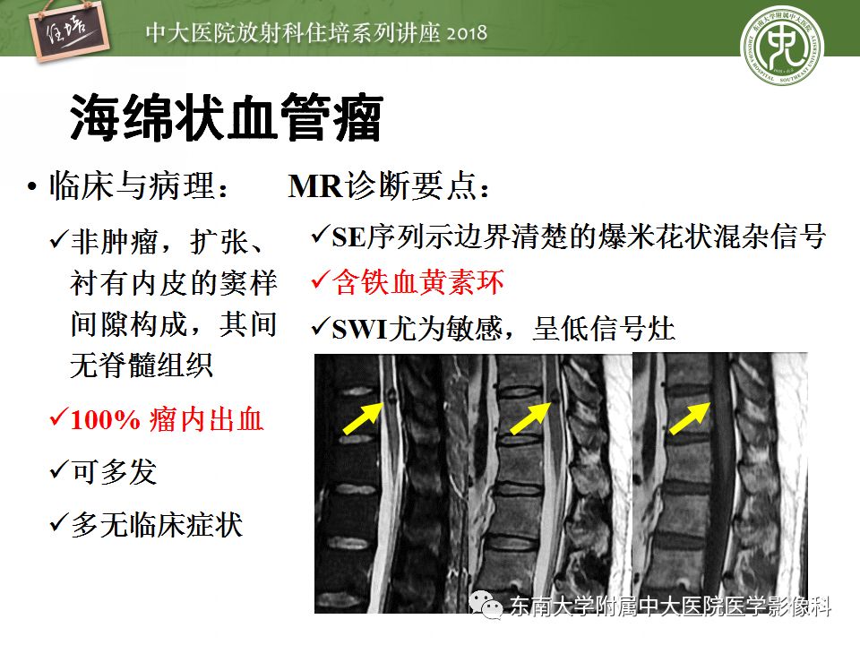 【PPT】脊髓内常见疾病的MR诊断