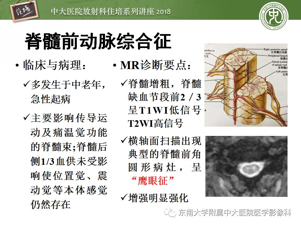 【PPT】脊髓内常见疾病的MR诊断