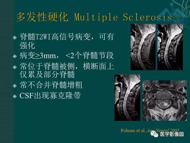 【PPT】脊髓急性炎性病变的影像诊断与鉴别诊断