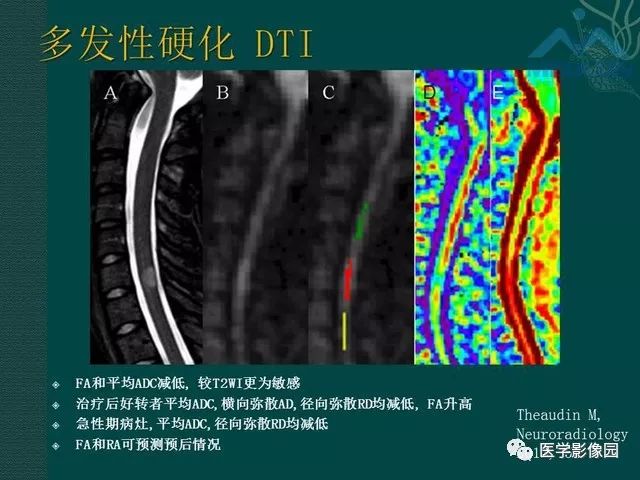 【PPT】脊髓急性炎性病变的影像诊断与鉴别诊断