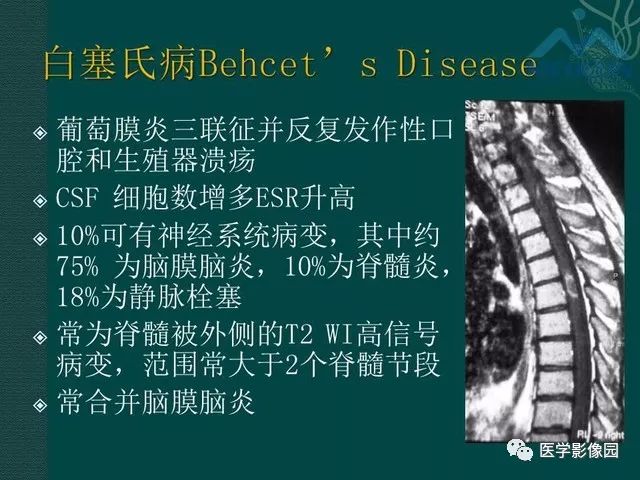 【PPT】脊髓急性炎性病变的影像诊断与鉴别诊断