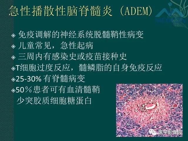 【PPT】脊髓急性炎性病变的影像诊断与鉴别诊断