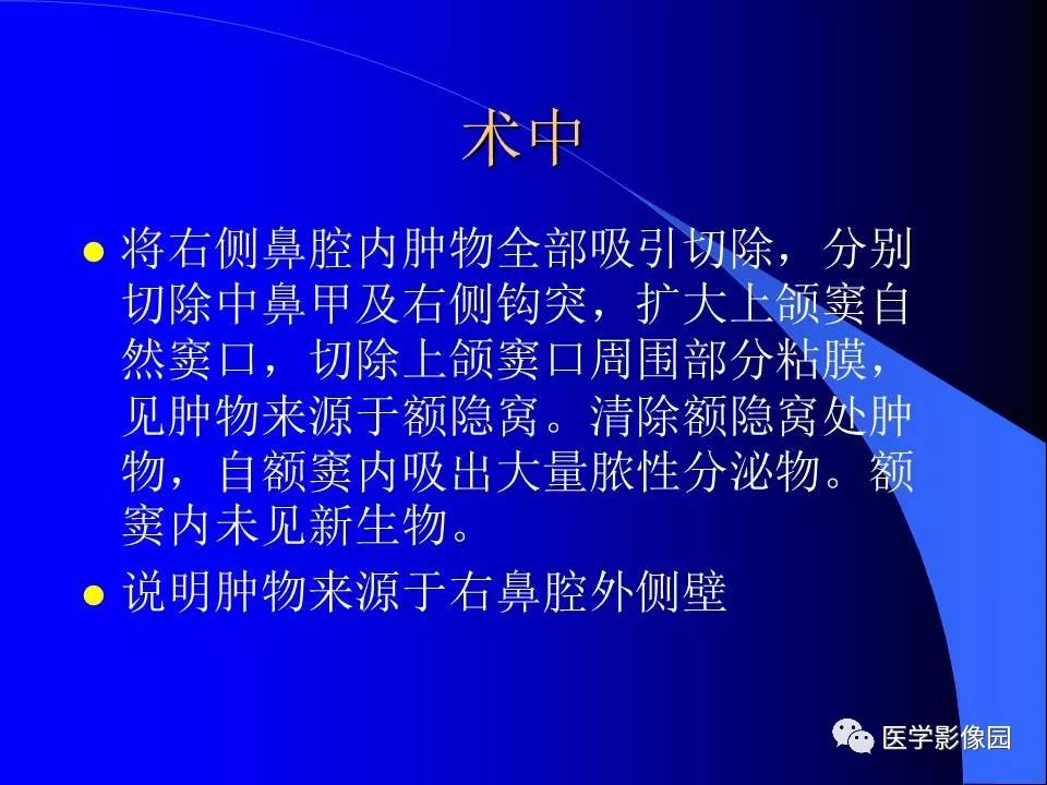 【病例】鼻腔内翻型乳头状瘤1例CT及MR影像诊断