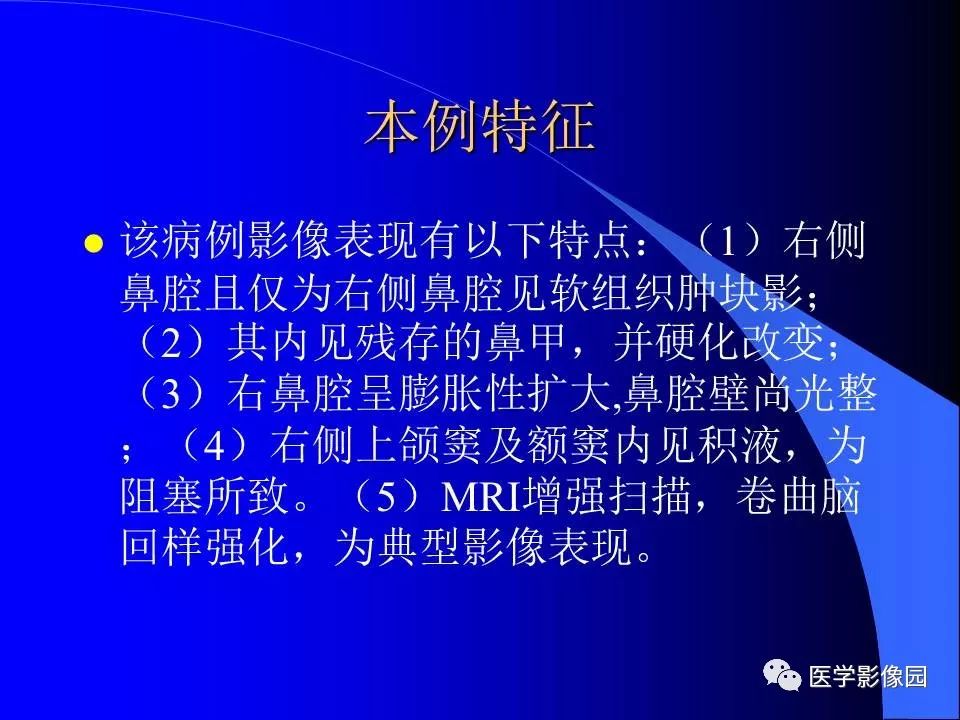 【病例】鼻腔内翻型乳头状瘤1例CT及MR影像诊断