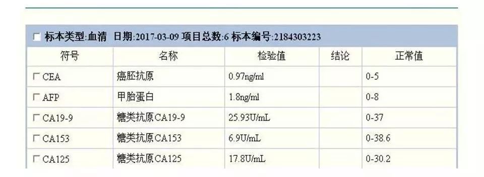 【病例】直肠乙状结肠交界处神经内分泌癌1例CT影像表现