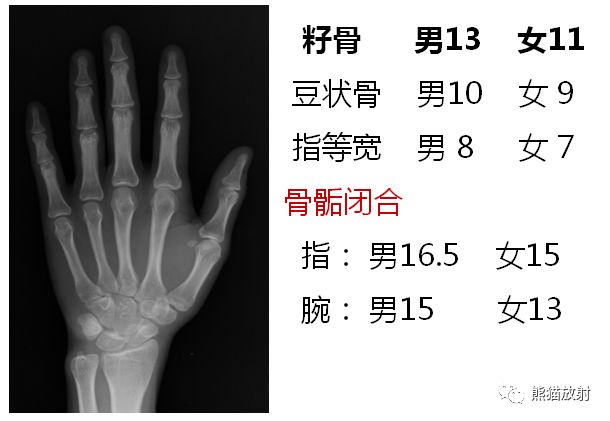 骨龄图谱 骨龄图谱