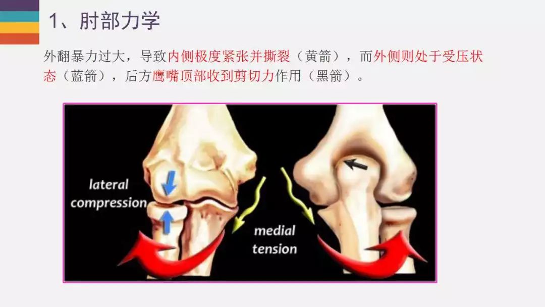 【PPT】肘关节常见病变MR诊断