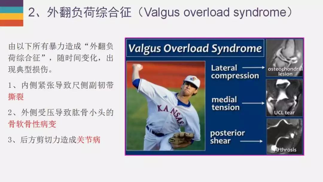 【PPT】肘关节常见病变MR诊断