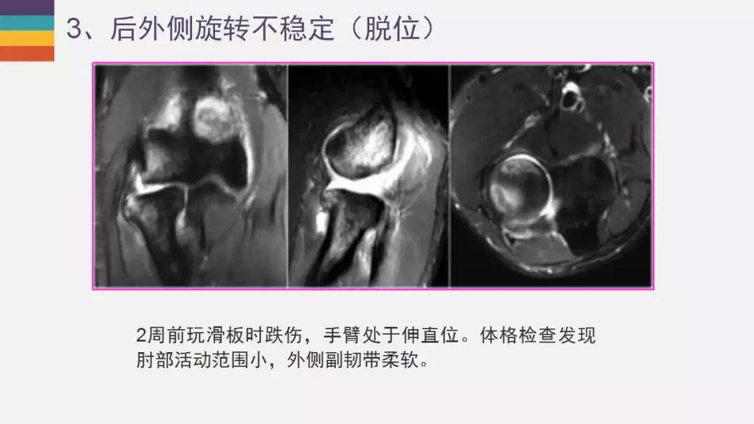 【PPT】肘关节常见病变MR诊断
