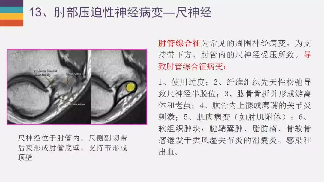 【PPT】肘关节常见病变MR诊断