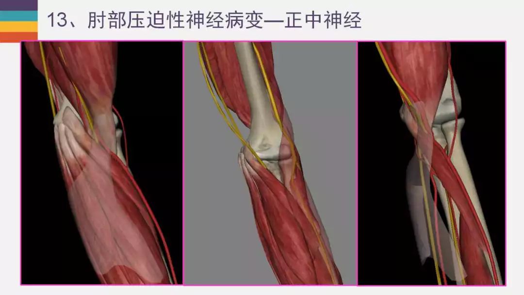 【PPT】肘关节常见病变MR诊断