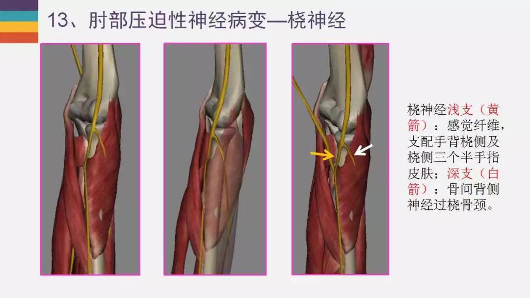 【PPT】肘关节常见病变MR诊断