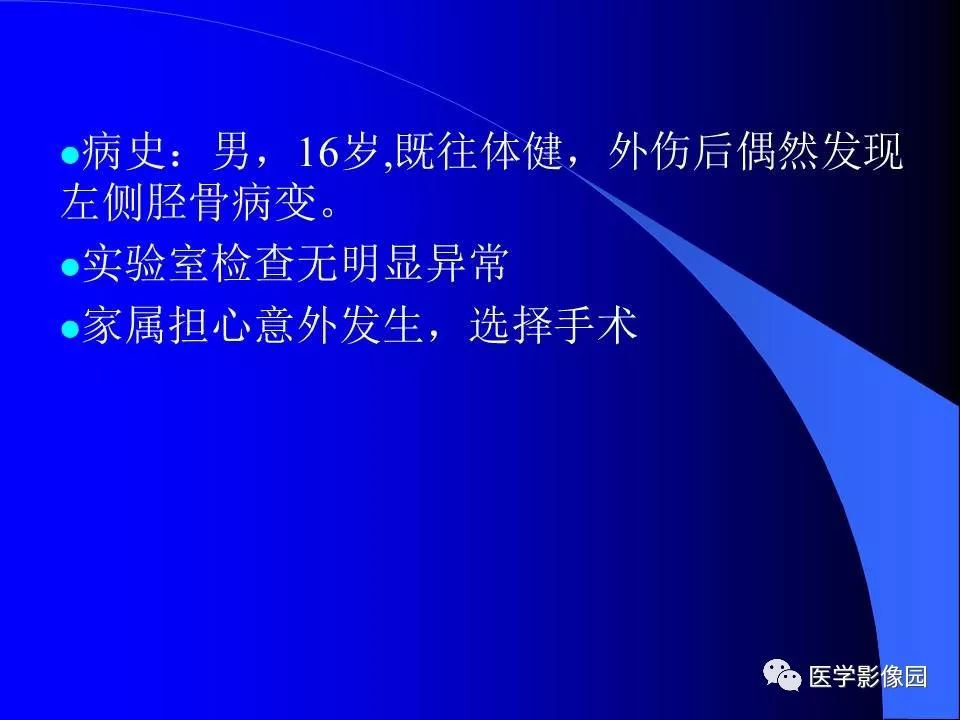 【病例】胫骨纤维性骨皮质缺损1例CT影像表现