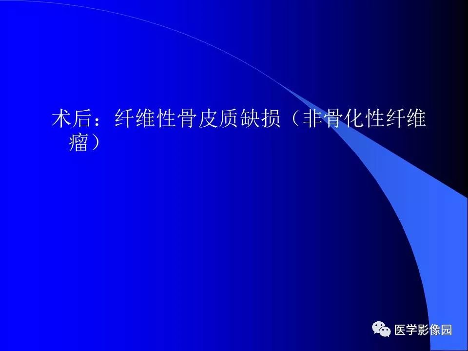 【病例】胫骨纤维性骨皮质缺损1例CT影像表现