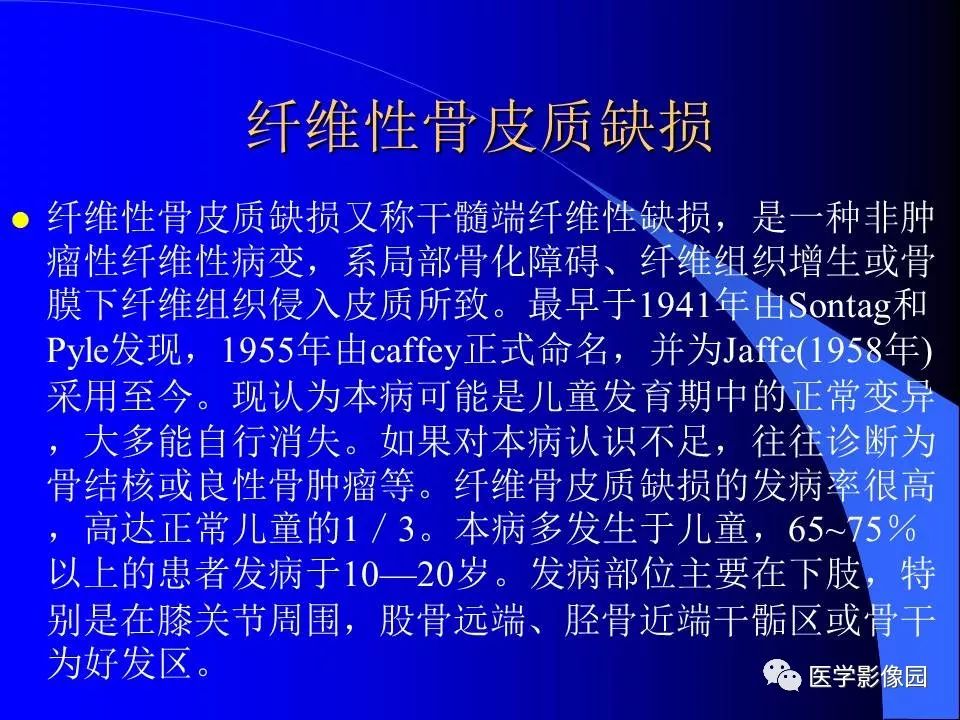 【病例】胫骨纤维性骨皮质缺损1例CT影像表现