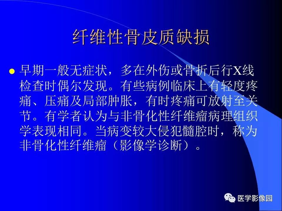 【病例】胫骨纤维性骨皮质缺损1例CT影像表现