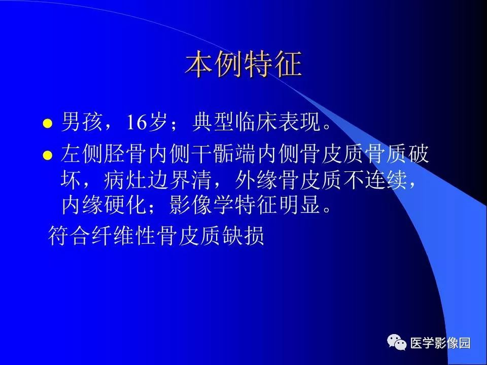 【病例】胫骨纤维性骨皮质缺损1例CT影像表现