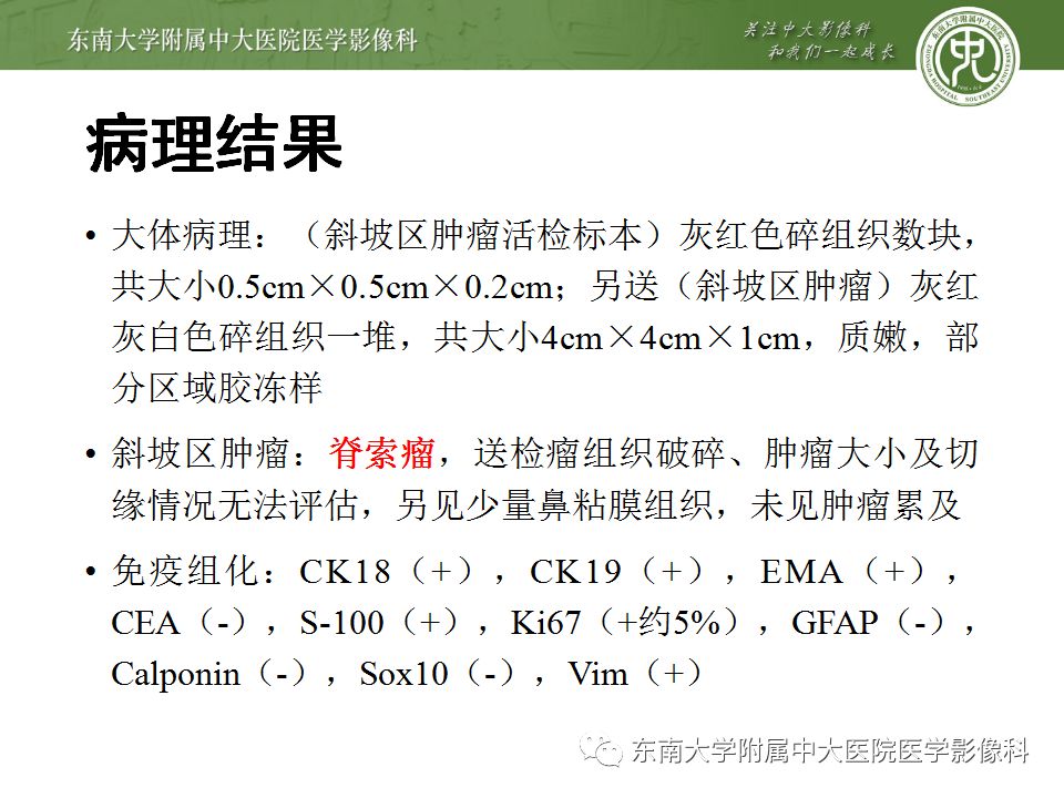 【病例】颅底脊索瘤1例CT及MR影像表现