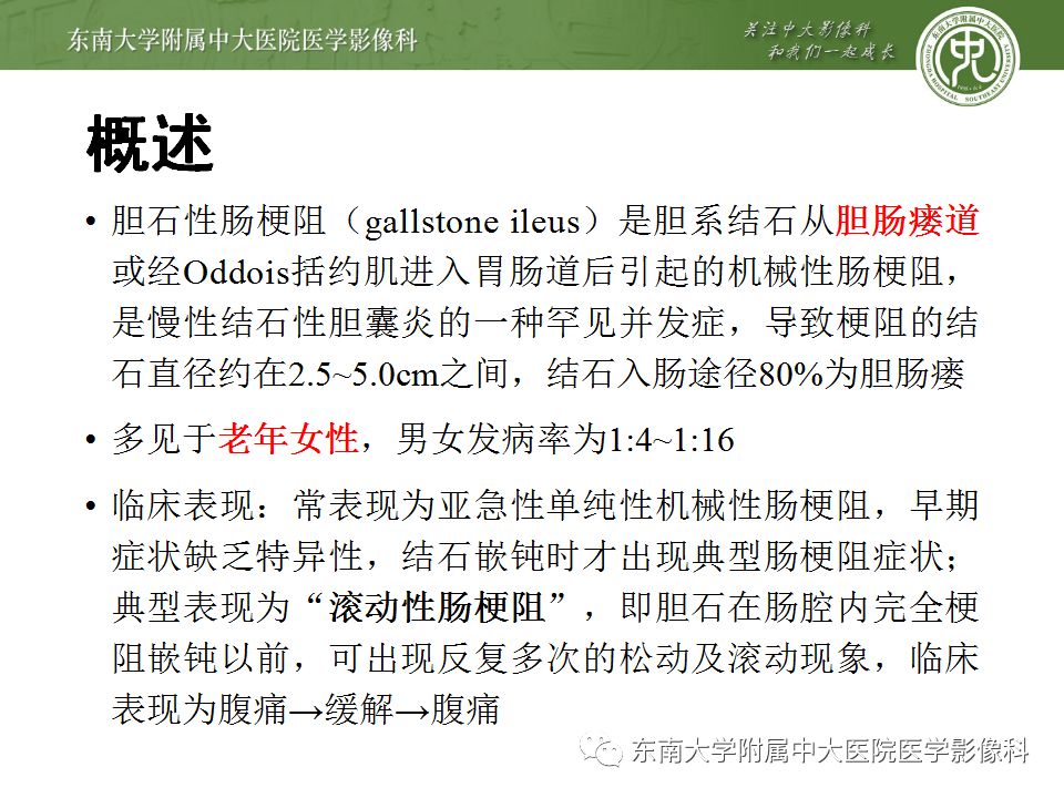 【病例】胆肠瘘并胆石性肠梗阻1例CT影像表现