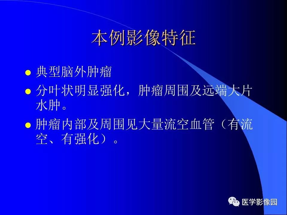 【病例】颅内血管外皮细胞瘤1例CT及MR影像表现