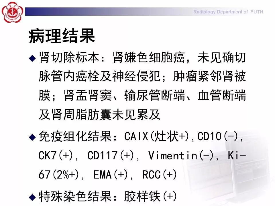【病例】 肾脏嫌色细胞癌1例CT及MR影像表现