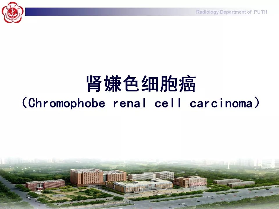 【病例】 肾脏嫌色细胞癌1例CT及MR影像表现