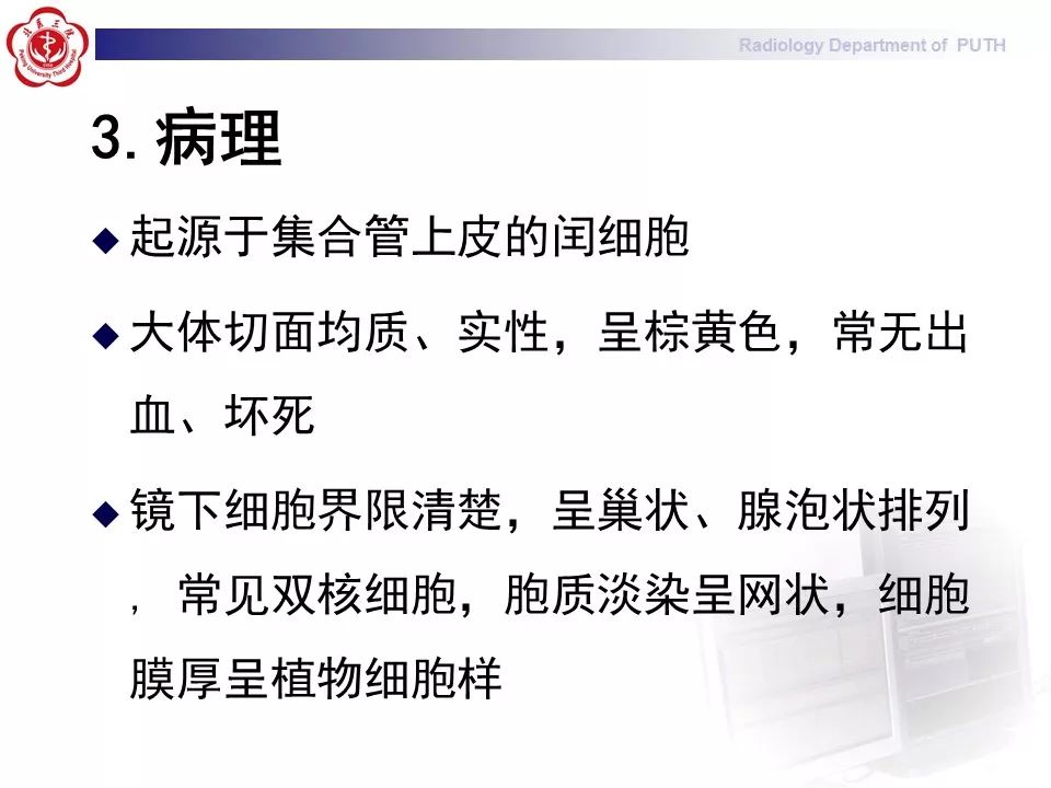 【病例】 肾脏嫌色细胞癌1例CT及MR影像表现