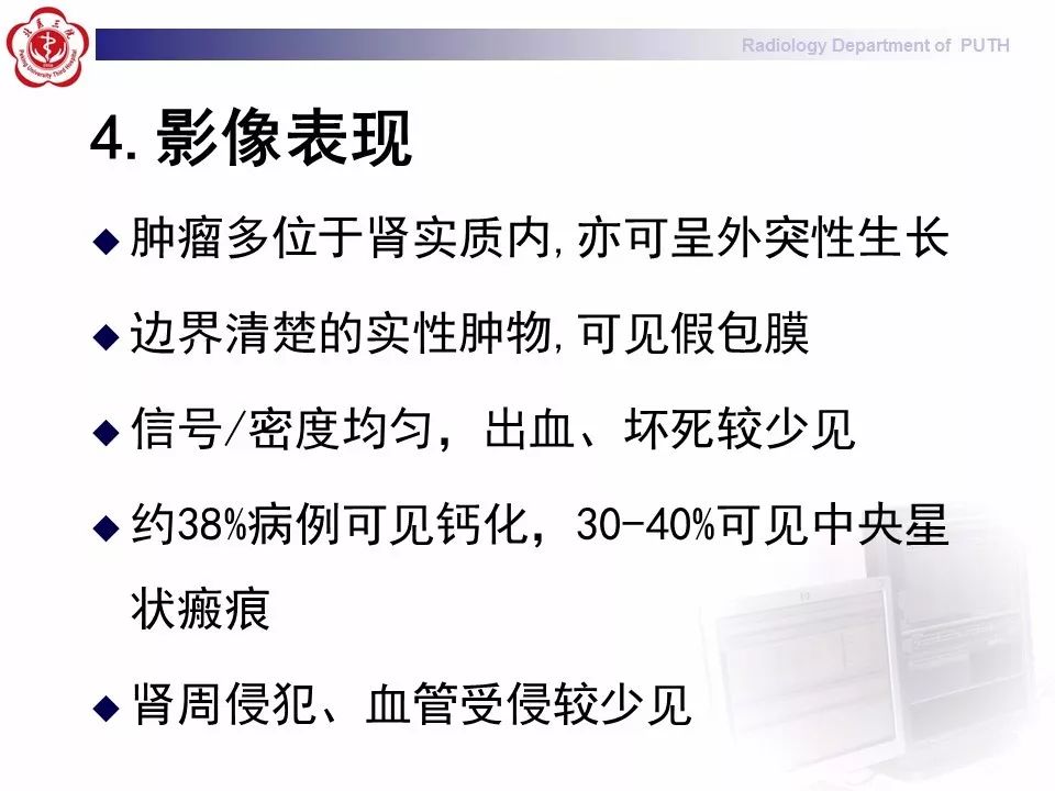 【病例】 肾脏嫌色细胞癌1例CT及MR影像表现