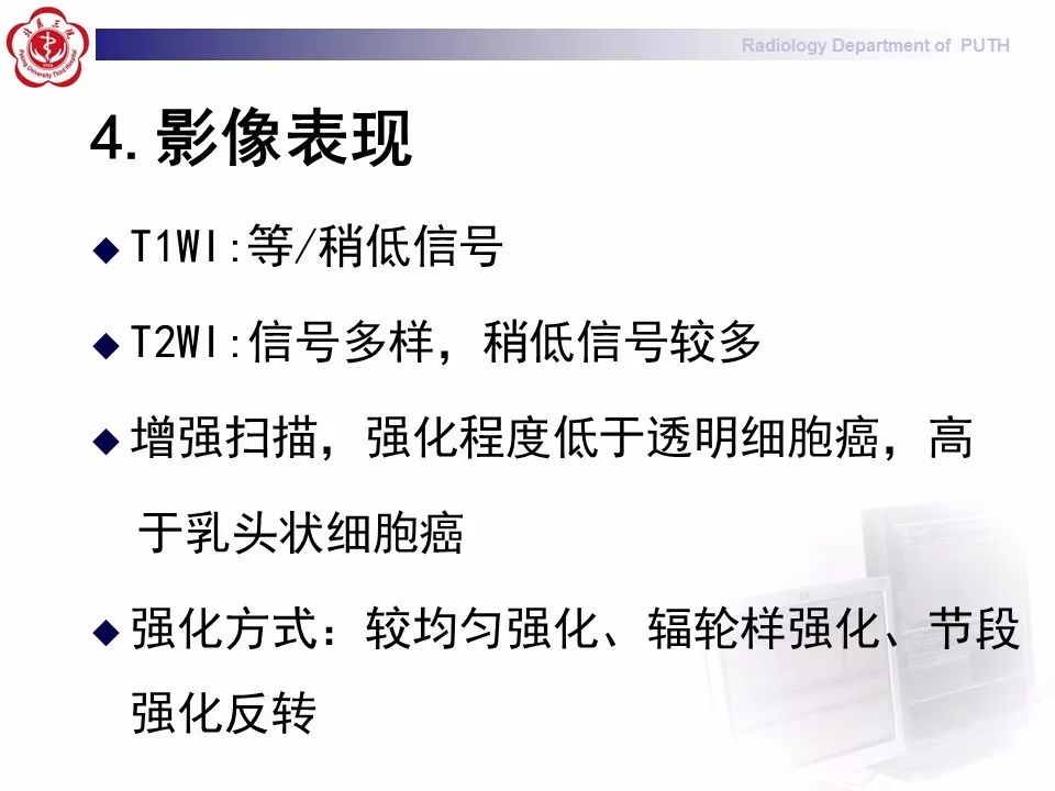 【病例】 肾脏嫌色细胞癌1例CT及MR影像表现