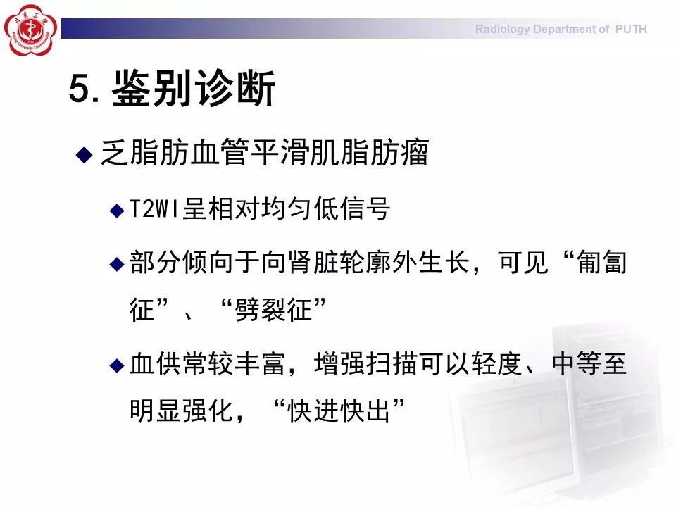 【病例】 肾脏嫌色细胞癌1例CT及MR影像表现