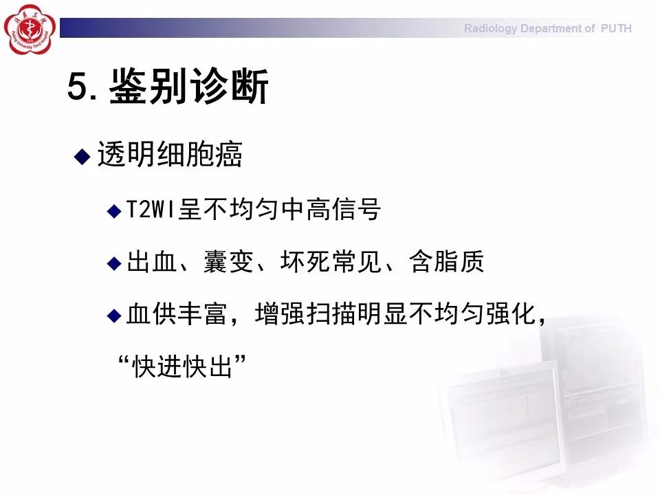 【病例】 肾脏嫌色细胞癌1例CT及MR影像表现