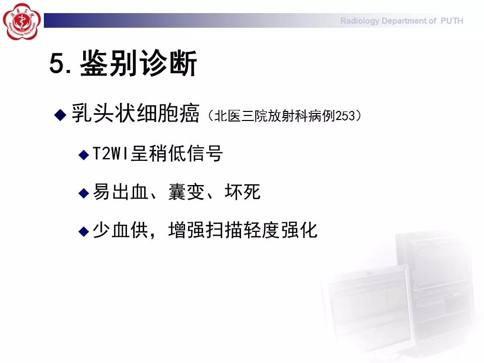 【病例】 肾脏嫌色细胞癌1例CT及MR影像表现