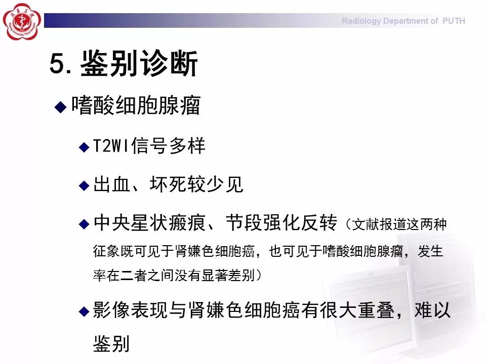 【病例】 肾脏嫌色细胞癌1例CT及MR影像表现