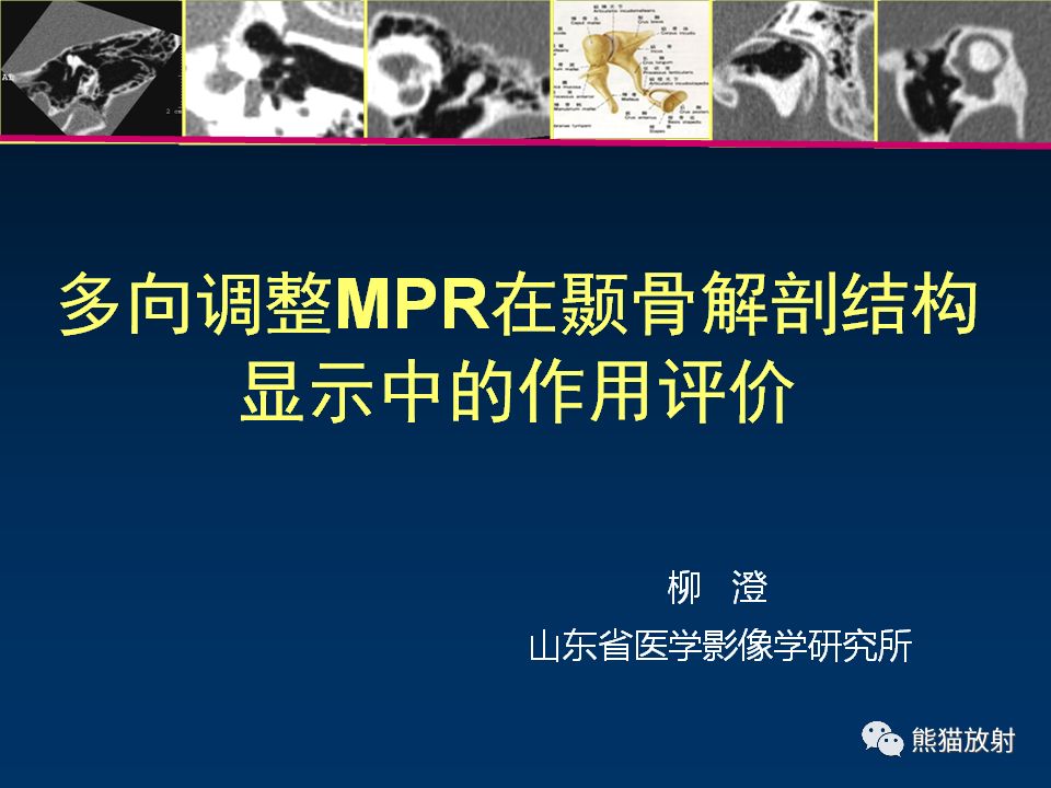【PPT】多向调整MPR在颞骨解剖结构显示中的作用评价