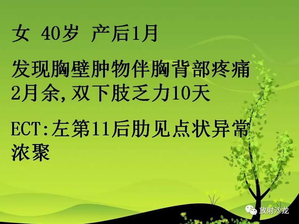 【病例】胸壁粒细胞肉瘤1例CT影像表现