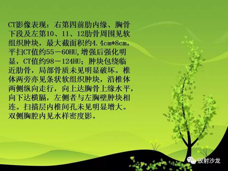 【病例】胸壁粒细胞肉瘤1例CT影像表现