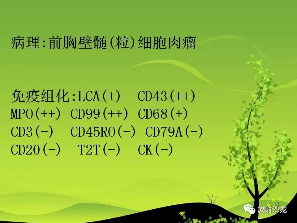 【病例】胸壁粒细胞肉瘤1例CT影像表现