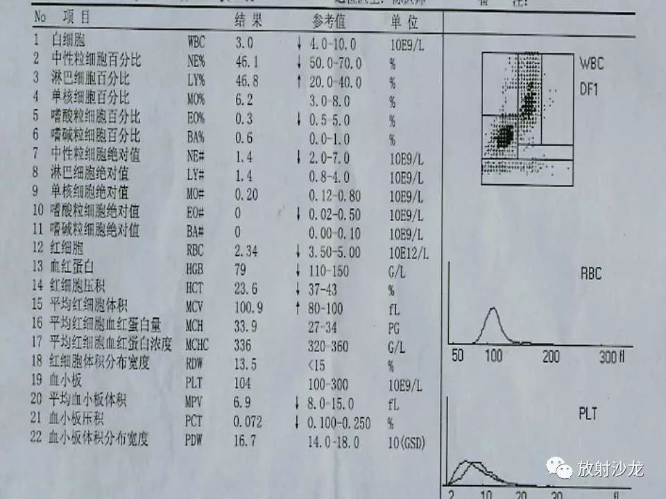 【病例】胸壁粒细胞肉瘤1例CT影像表现