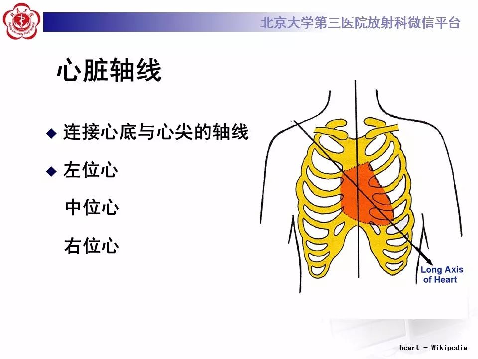 【病例】先天性心脏病诊断思路与基本征象
