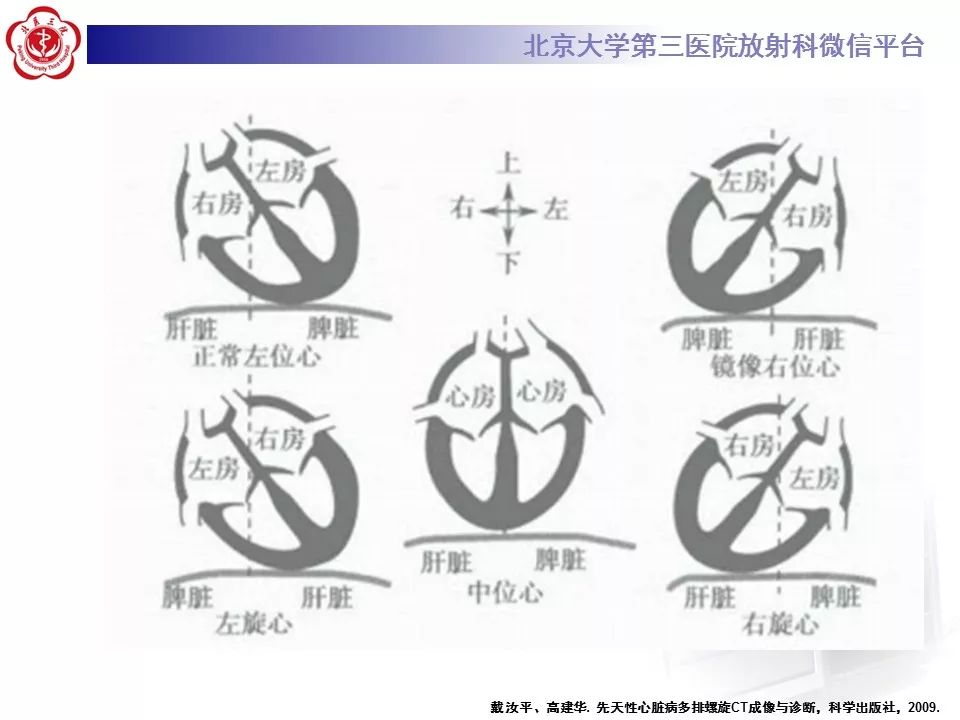 【病例】先天性心脏病诊断思路与基本征象